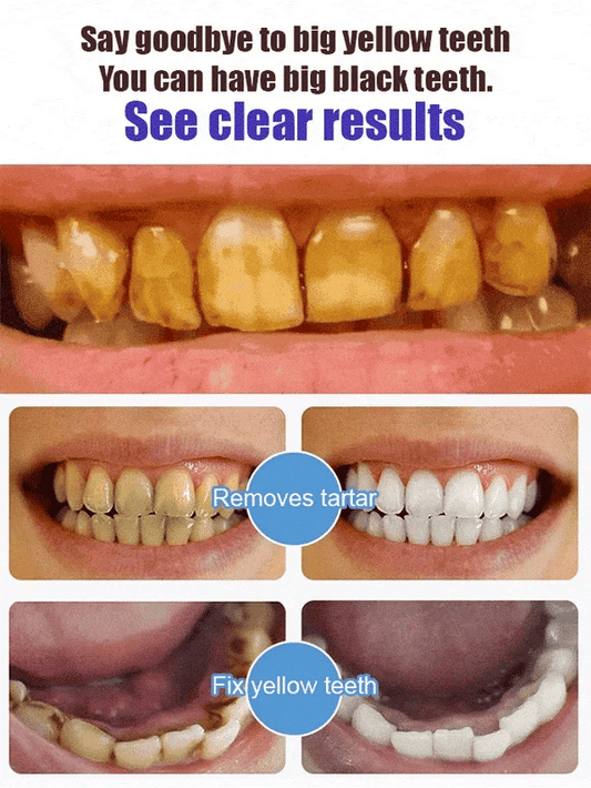 🔥LAST DAY SALE 49% OFF🔥Probiotic Whitening Toothpaste